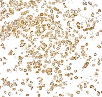 Rabbit anti-EGFR Recombinant Monoclonal Antibody [BLR252L]