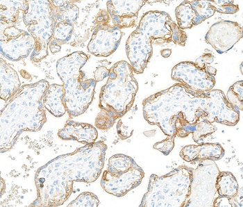 Rabbit anti-EGFR Recombinant Monoclonal Antibody [BLR252L]