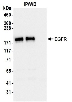 Rabbit anti-EGFR Recombinant Monoclonal Antibody [BLR252L]