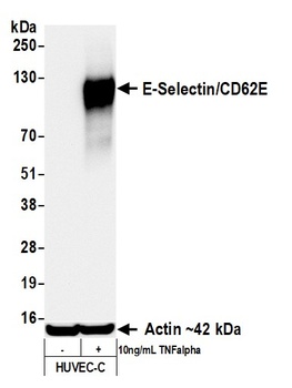 Rabbit anti-E-Selectin/CD62E Recombinant Monoclonal Antibody [BLR295L]