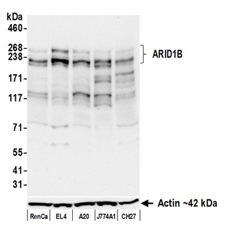 Rabbit anti-ARID1B Recombinant Monoclonal Antibody [BLR291L]
