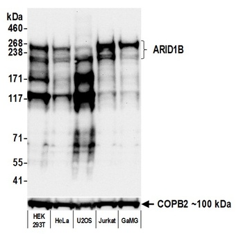 Rabbit anti-ARID1B Recombinant Monoclonal Antibody [BLR291L]