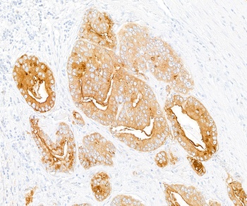 Rabbit anti-DPP4/CD26 Recombinant Monoclonal Antibody [BLR288L]