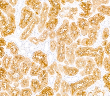Rabbit anti-DPP4/CD26 Recombinant Monoclonal Antibody [BLR288L]
