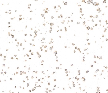 Rabbit anti-CD39 Recombinant Monoclonal Antibody [BLR285L]