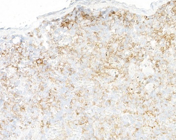 Rabbit anti-CD39 Recombinant Monoclonal Antibody [BLR285L]