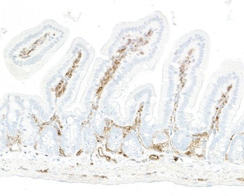Rabbit anti-CD39 Recombinant Monoclonal Antibody [BLR285L]