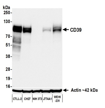 Rabbit anti-CD39 Recombinant Monoclonal Antibody [BLR285L]