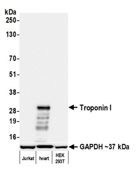 Rabbit anti-Troponin I Recombinant Monoclonal Antibody [BLR280L]