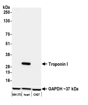 Rabbit anti-Troponin I Recombinant Monoclonal Antibody [BLR280L]