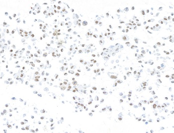 Rabbit anti-ARID1A/BAF250 Recombinant Monoclonal Antibody [BLR279L]