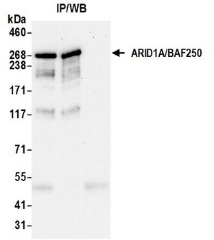 Rabbit anti-ARID1A/BAF250 Recombinant Monoclonal Antibody [BLR279L]