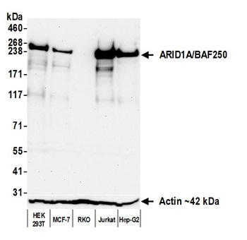 Rabbit anti-ARID1A/BAF250 Recombinant Monoclonal Antibody [BLR279L]