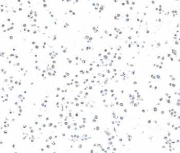Rabbit anti-ARID1A/BAF250 Recombinant Monoclonal Antibody [BLR279L]