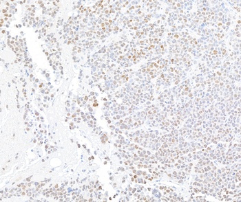 Rabbit anti-ARID1A/BAF250 Recombinant Monoclonal Antibody [BLR279L]
