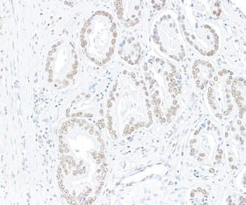 Rabbit anti-ARID1A/BAF250 Recombinant Monoclonal Antibody [BLR279L]