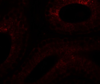 SPATA6 Antibody