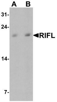 Betatrophin Antibody