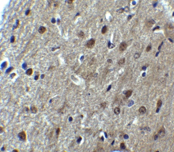 ARID1A Antibody