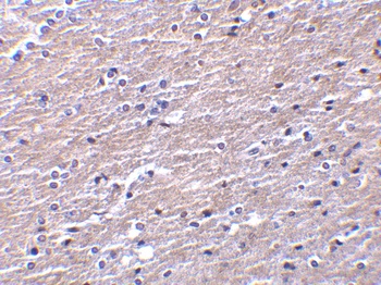 Clusterin Antibody