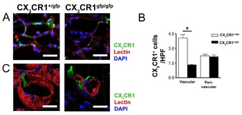 CX3CR1 Antibody