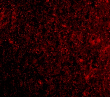PD-1 Antibody