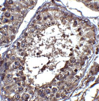 PIST Antibody