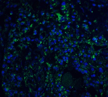 STAT1 alpha Antibody