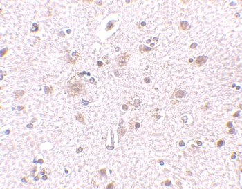 BRCC45 Antibody