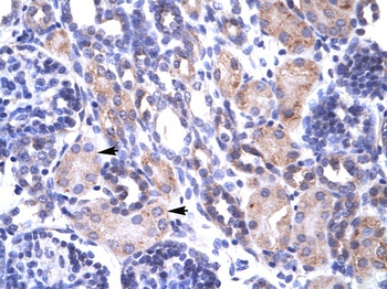 TRAP1 Antibody