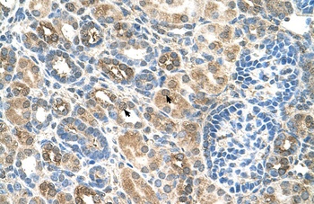 SLC22A16 Antibody