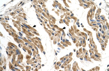 SLC35F2 Antibody