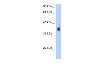 SLC35F2 Antibody