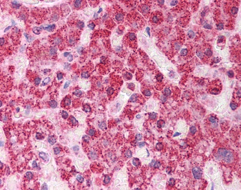 TST Antibody