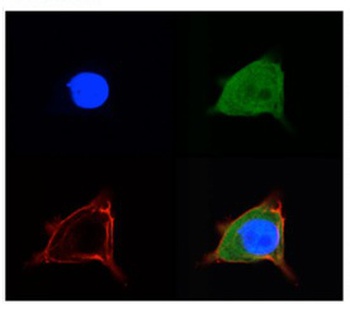SLC2A5 Antibody