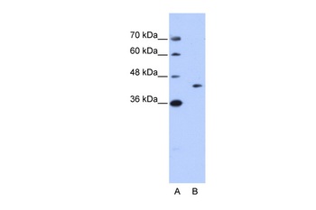 GIPC1 Antibody