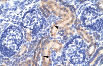 PCK1 Antibody