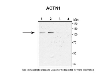 Actin alpha 1 Antibody