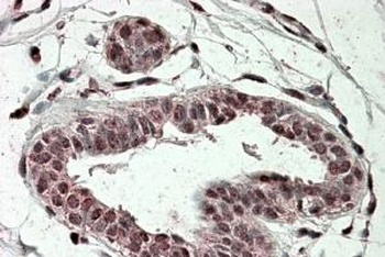 NR1I2 Antibody