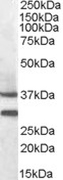 NR1I2 Antibody