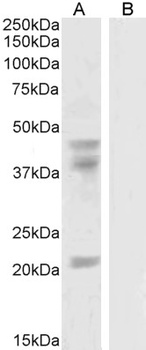 Collagen VII Antibody
