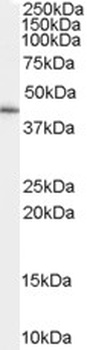 SLC22A16 Antibody