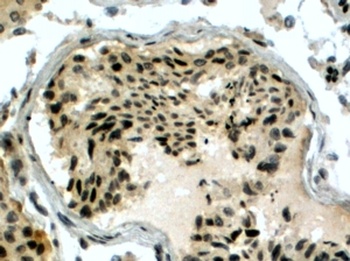 PIR51 Antibody