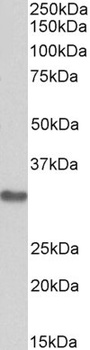 SNX1 Antibody