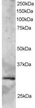 GCIP Interacting Protein Antibody