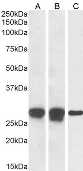 COL4A3BP Antibody