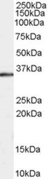 CHIP Antibody