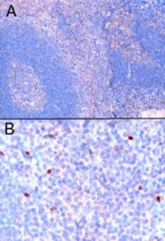FOXP3 Antibody