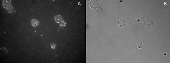 FOXP3 Antibody