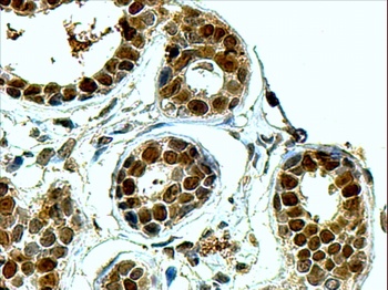 APEX1 Antibody